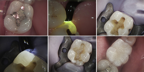 Biomimetic Dentistry