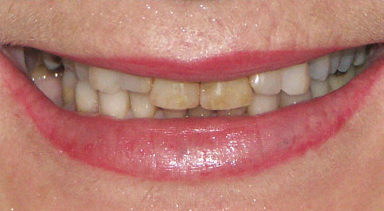 Cosmetic Before 3