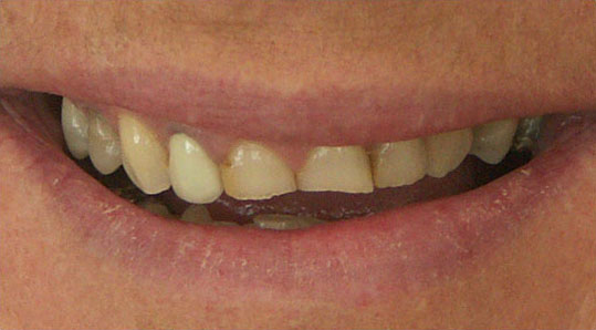 Cosmetic Before 4