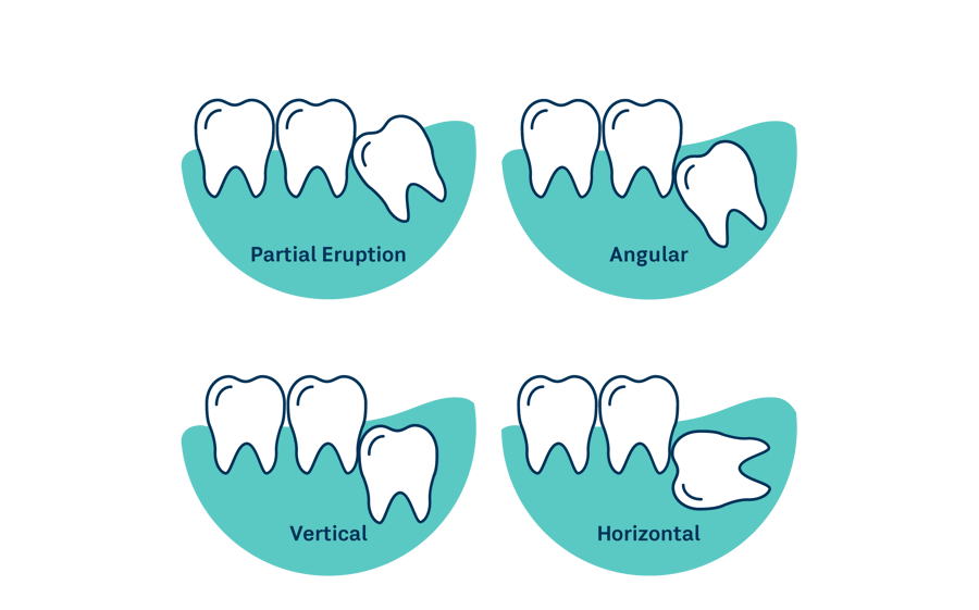 LUM0003 Lumino Infographics 10