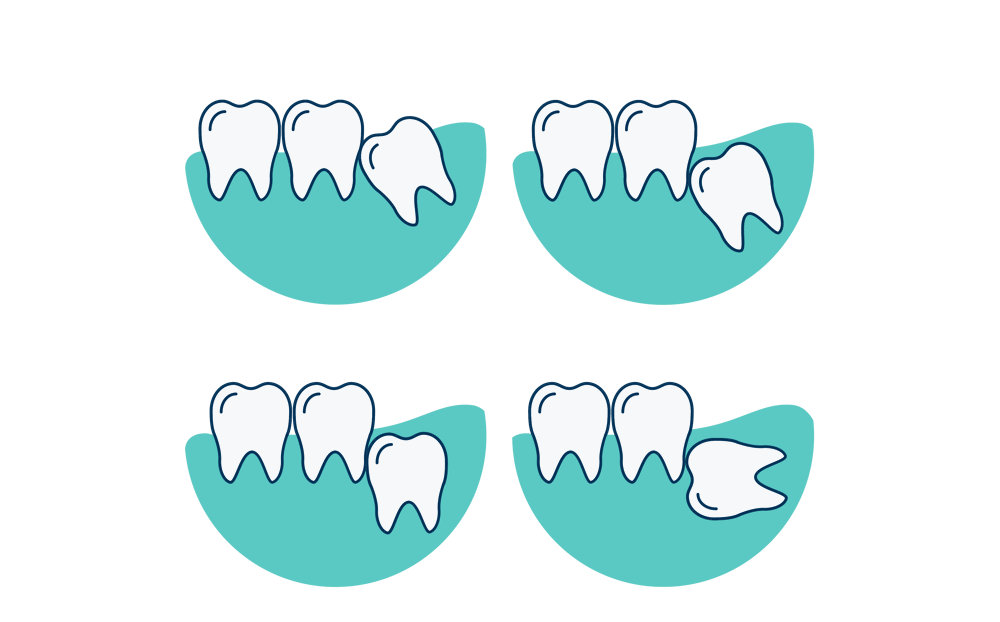 LUM0003 Lumino Infographics 11