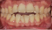 M B Beforeafter 01