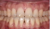 M B Beforeafter 02