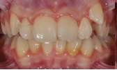 M B Beforeafter 03