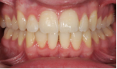 M B Beforeafter 04