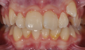 M B Beforeafter 05
