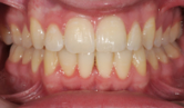 M B Beforeafter 06