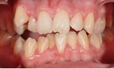 M B Beforeafter 09