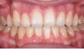 M B Beforeafter 10