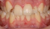 M B Beforeafter 17