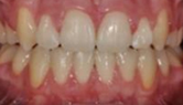 M B Beforeafter 18