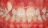 M B Beforeafter 23