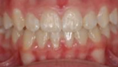 M B Beforeafter 24