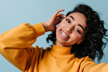 Holiday Food You Should and Shouldn't Eat With Braces